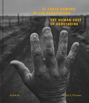 Human Cost, The Agrotoxins In Argentina